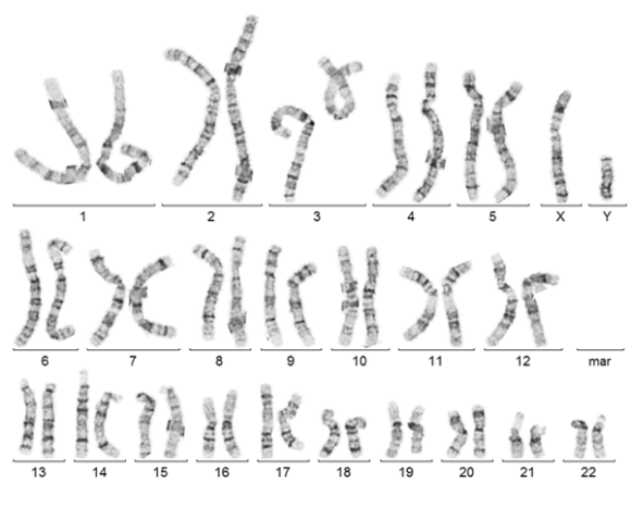 Abb_regelrechter-männlicher-Karyotyp-46,XY Abb_regelrechter-männlicher-Karyotyp-46,XY
