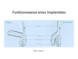 Penisimplantat_Funktionsweise