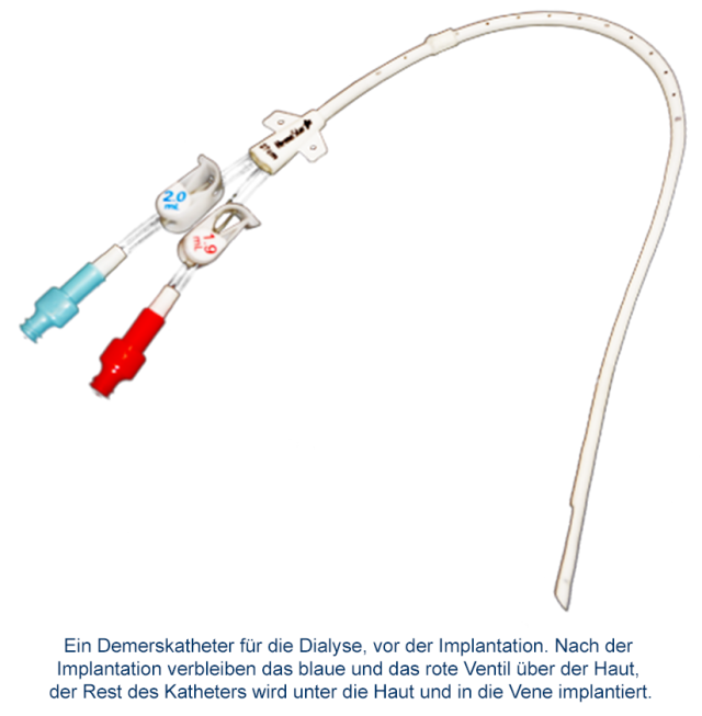Periphere_Venenzugänge_Demers_1 Periphere_Venenzugänge_Demers_1