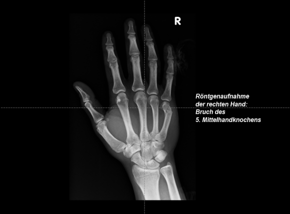 Radiologie_Roentgen_Hand_800